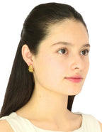 Arete C Tipo Irregular